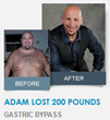 Adam lost 200 Pounds with Gastric Bypass