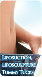 Liposuction, Liposculpture, Tummy Tucks