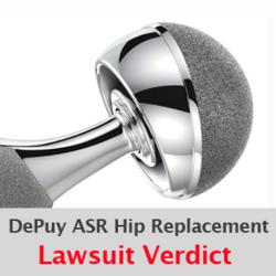If you or someone you love were injured by a DePuy ASR hip replacement recall device, please visit yourlegalhelp.com, or call toll-FREE 1-800-399-0795