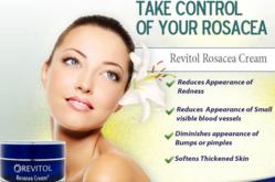Rosacea Cream Reviews