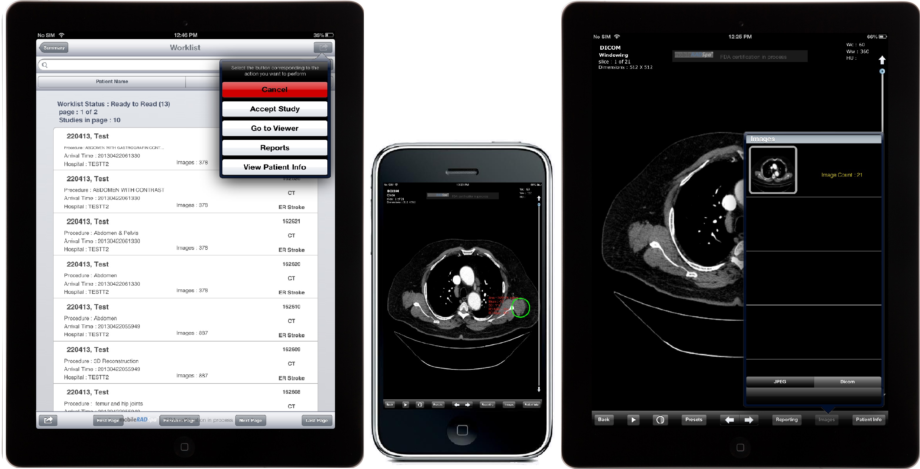 mobileRADSpa™- Radiology Software for iPad