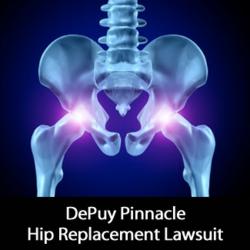 DePuy Pinnacle Hip Replacement Lawsuit Filed by Wright & Schulte on ...