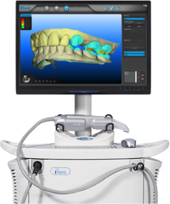 iTero scanner, now at Burch Orthodontics