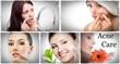 how to treat acne acne cured can