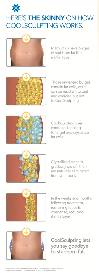 How CoolSculpting® Freezes Away Pockets of Unwanted Fat