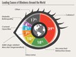 Leading Causes of blindness Around the World