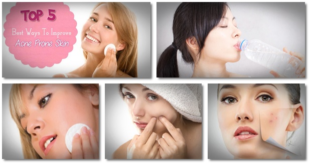 Diet For Acne Prone Skin Acne Remedies Guide Reveals To People A 