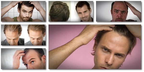 hair loss treatment for men