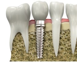 dental procedures in las vegas