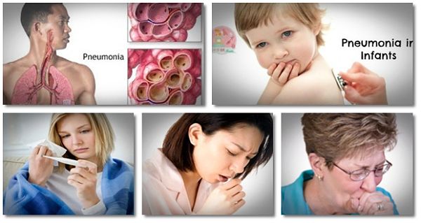 A New Article Releases 16 Home Remedies For Pneumonia – Healthreviewcenter