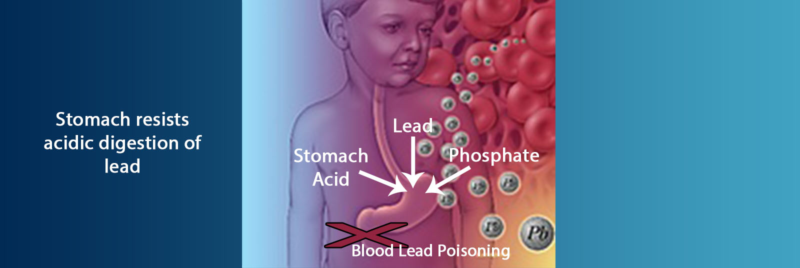 ECOBOND LBP reduces ability to absorb lead into the bloodstream