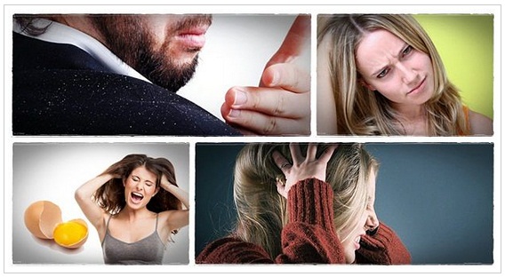 how to treat dandruff at home