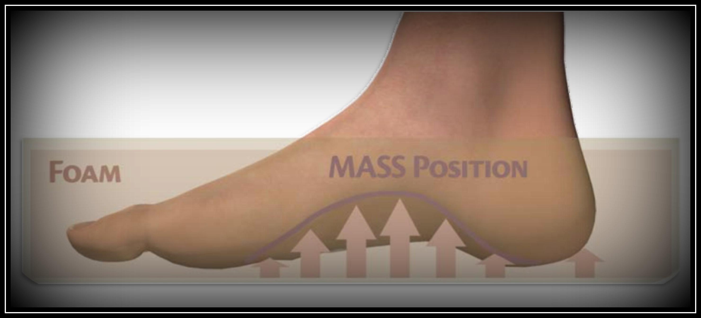 MASS position (Maximal Arch Supination Stabilization)