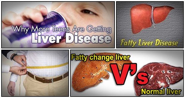 the fatty liver bible and ezra protocol review