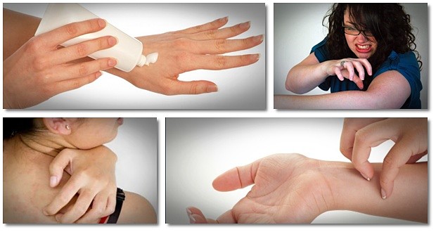 home remedies for itching skin