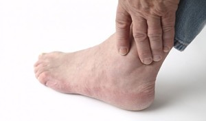 how to prevent gout