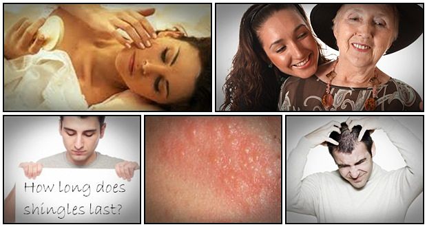 fast shingles cure review