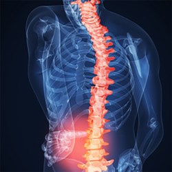 RB Spine Center Announces the Addition of IDD Therapy for Back Pain