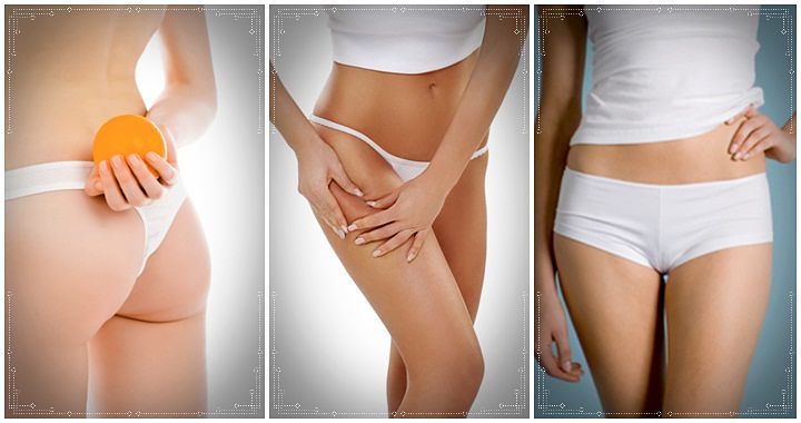 cellulite the natural cure review