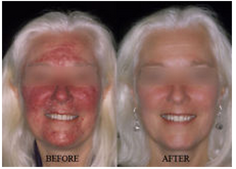 Ethos Spa Acne/Anti Aging Prep addresses adult acne as well as signs of aging.