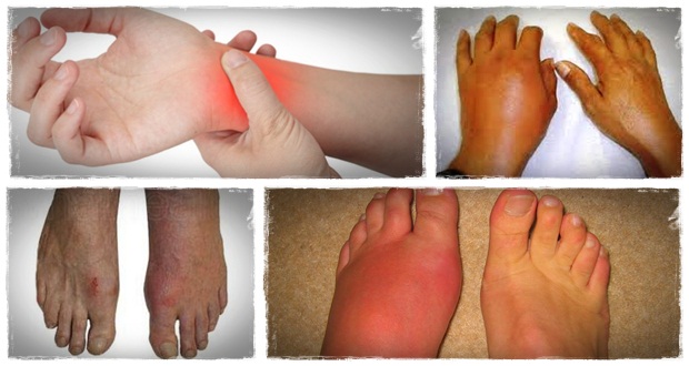 the gout remedy report