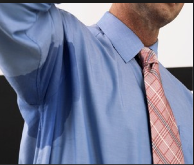 Excessive Sweating can be treated with BOTOX
