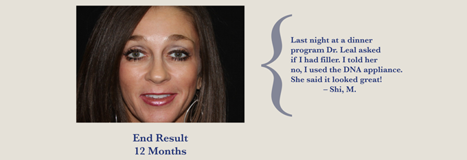 12 month results of non-surgical facelift