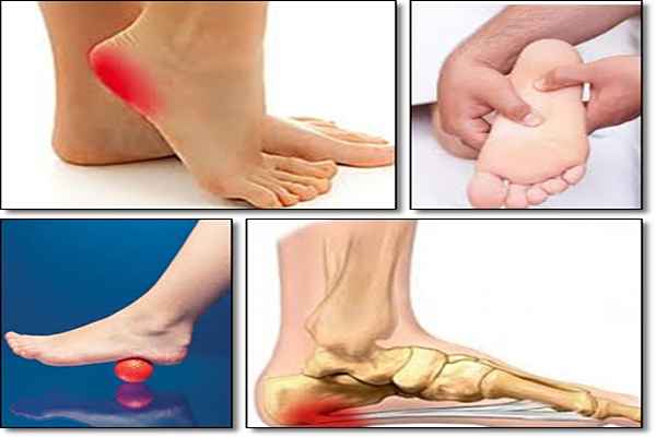 Plantar Fasciitis Secrets Revealed Review