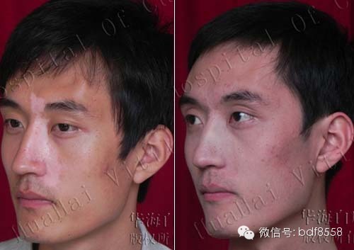 Compared photos of Zhao lei