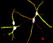 human neurons