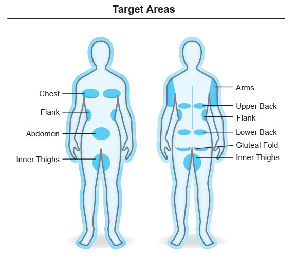 Body Areas For Coolsculpting