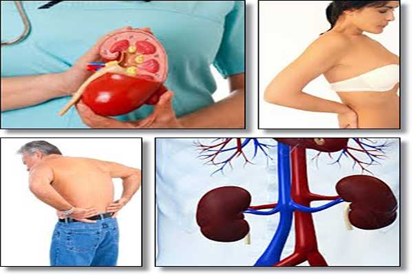 All Natural Kidney Health and Kidney Function Restoration Program Review