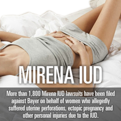 Mirena IUD Lawsuits Climb As Filings In State And Federal Litigations   GI 59621 Mirena IUD Lawsuit Attorney Side Effects 