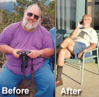 gastric bypass success story