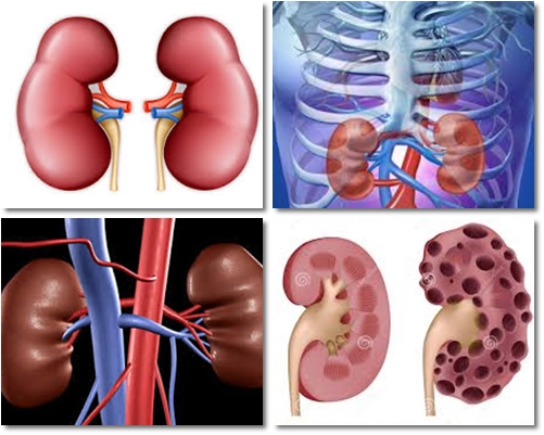 A Article On Kidney Disease What Should