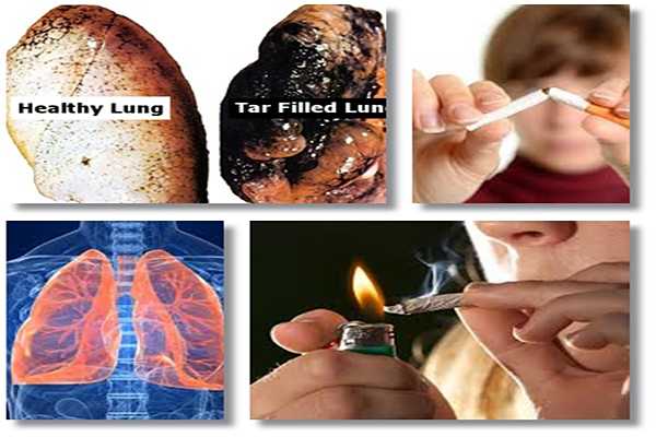 Lung Detoxification Review