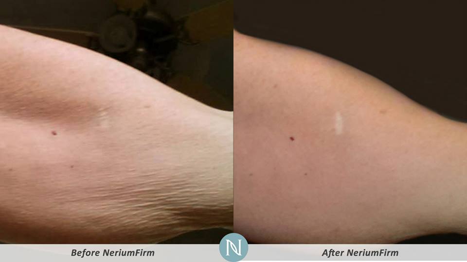 NeriumFirm Results