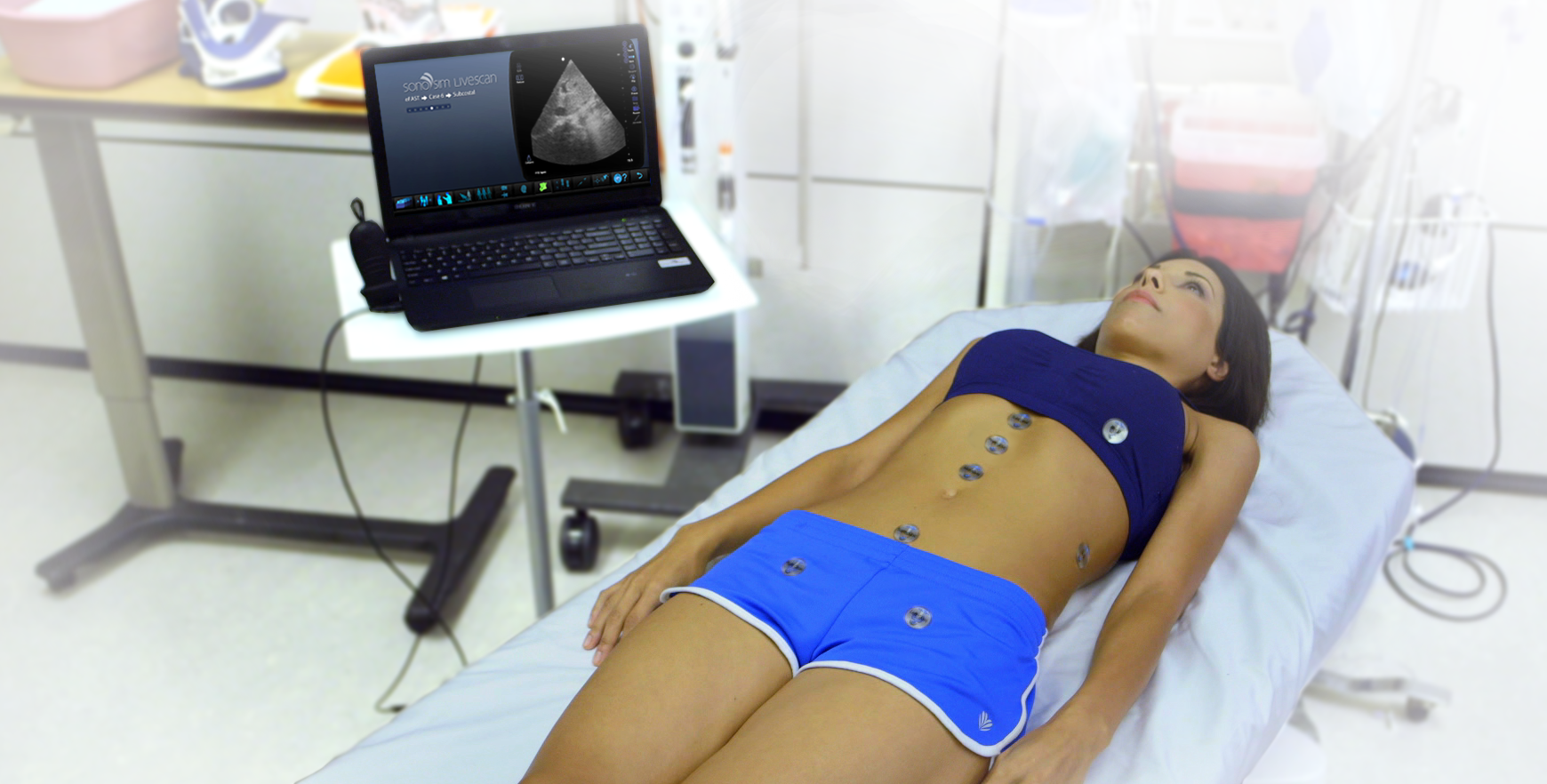 SonoSim LiveScan™ instantly transforms healthy volunteers into ultrasound training cases with real pathologic conditions.