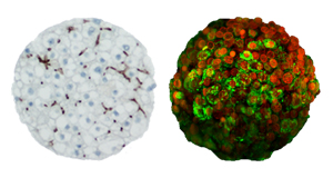 Human (left) and HepG2 (right) 3D InSight(TM) Liver Microtissues from InSphero are used to help predict toxicity of drugs before they reach patients.