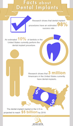 Facts about dental implants.