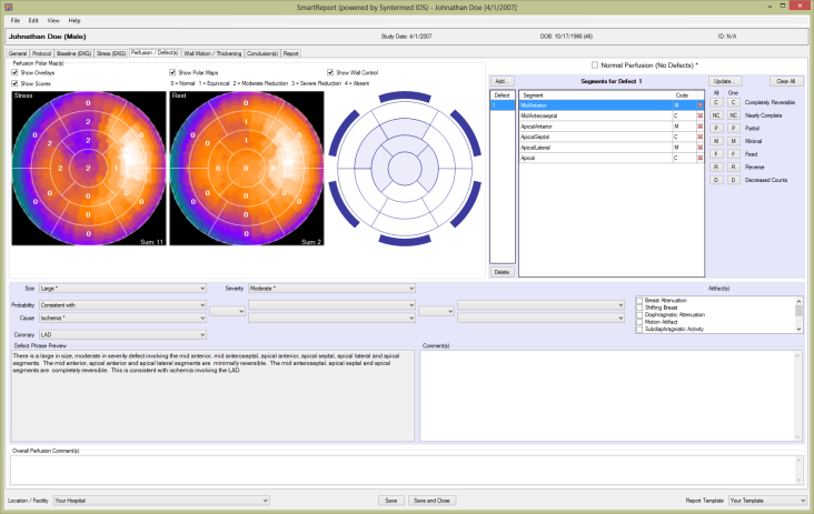 Syntermed IDS, clinical decision support powers SmartReport