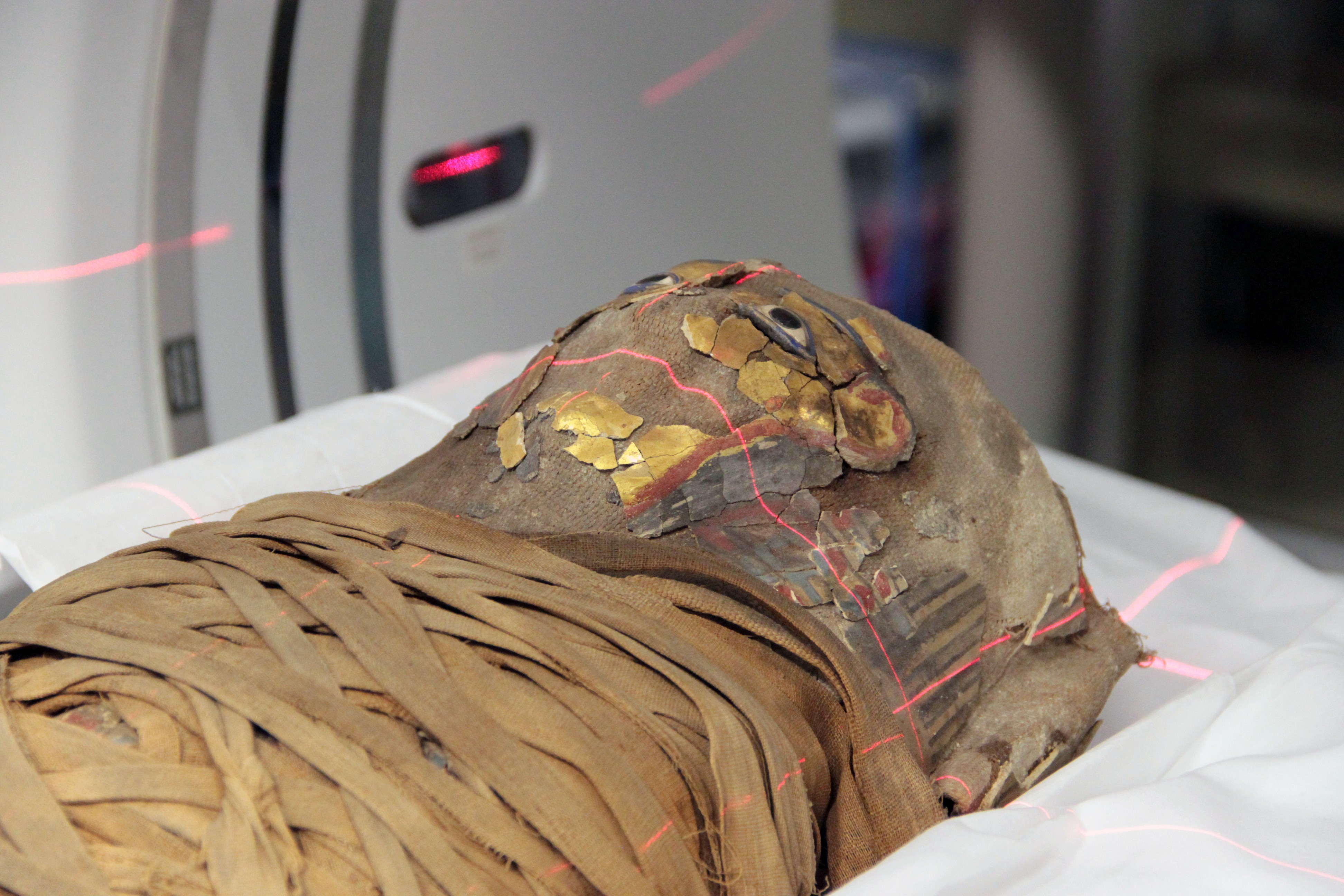The CT scan on a toddler mummy revealed that she may have died from a ruptured appendix.