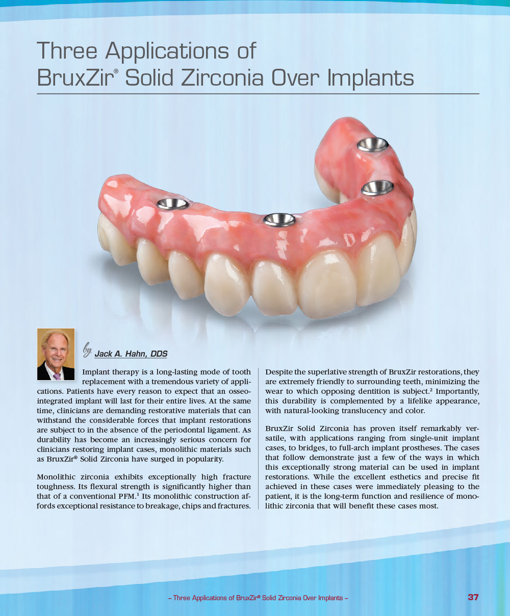 Three Applications of BruxZir® Solid Zirconia Over Implants by Jack A. Hahn, DDS