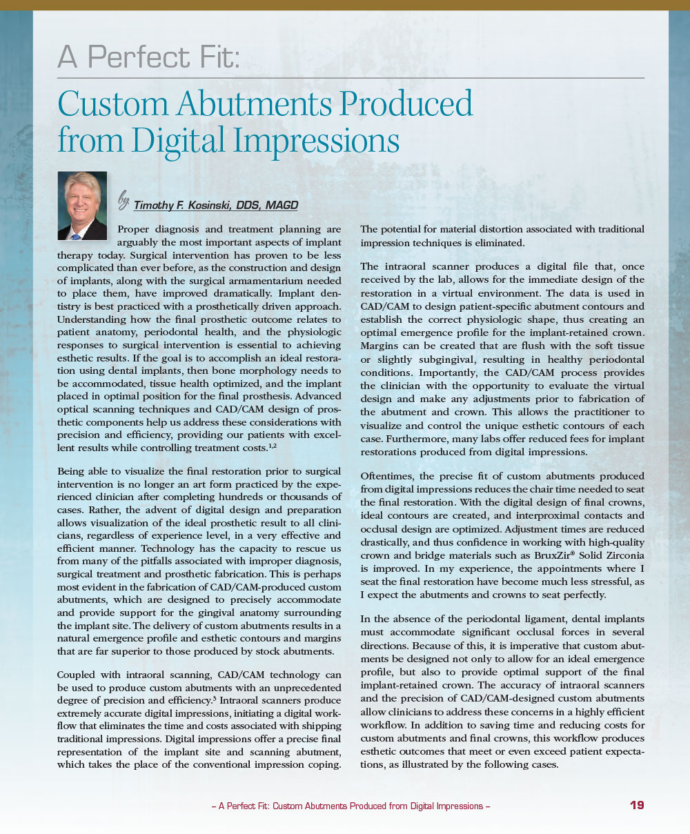A Perfect Fit: Custom Abutments Produced from Digital Impressions by Timothy F. Kosinski, DDS, MAGD
