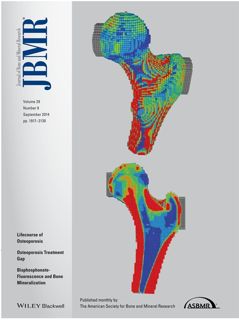 Study image is featured on the cover of the Journal of Bone Mineral Research. Red areas of the bone are stiffer and blue areas are less stiff.