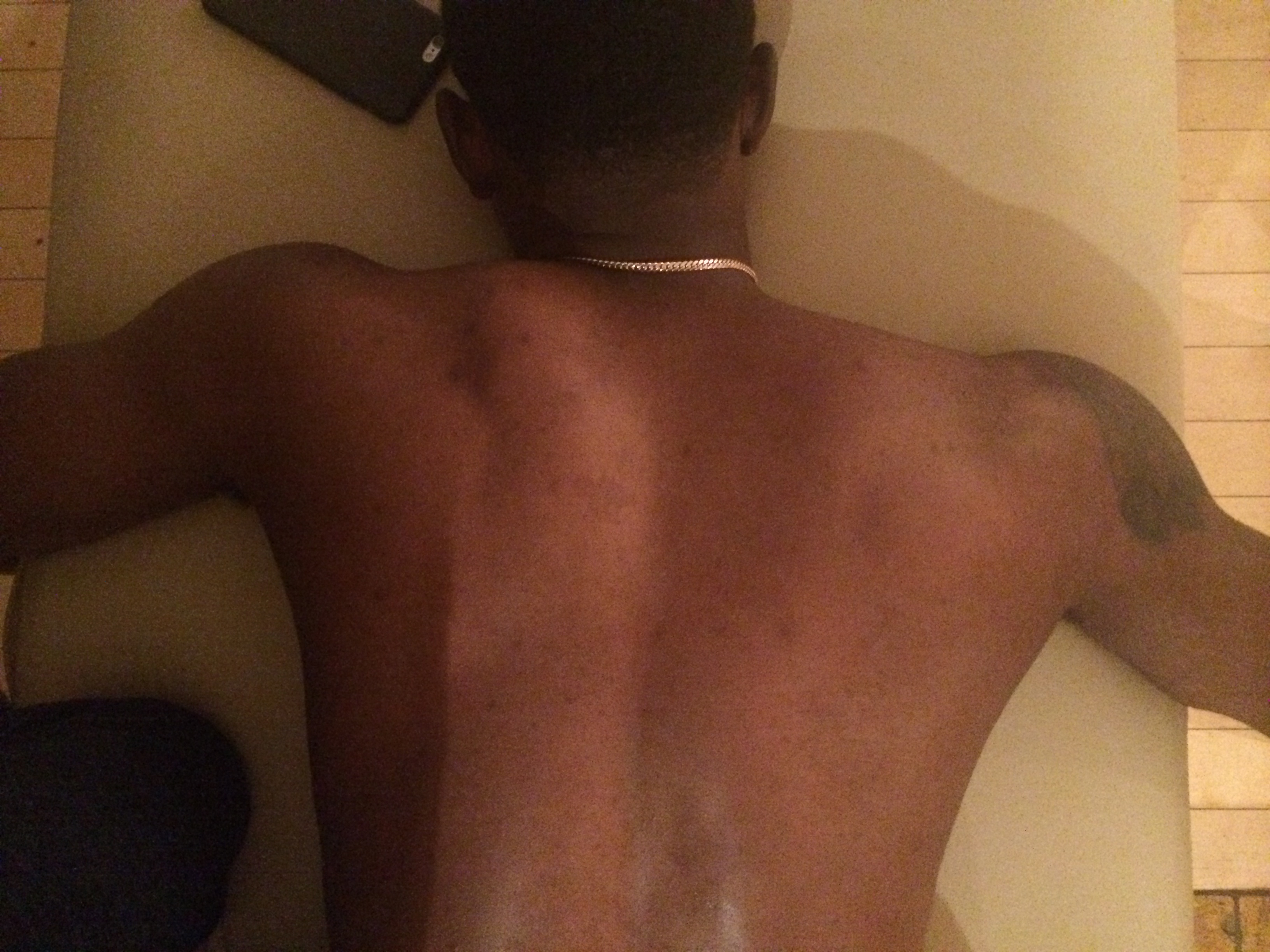 MLB ALL-STAR Dee Gordon, shows fascia bound tissue on the left shoulder and treated fascia on the left.