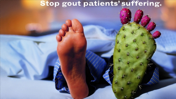 Gout symptoms usually consist of intense episodes of extremely painful swelling, most often in the feet