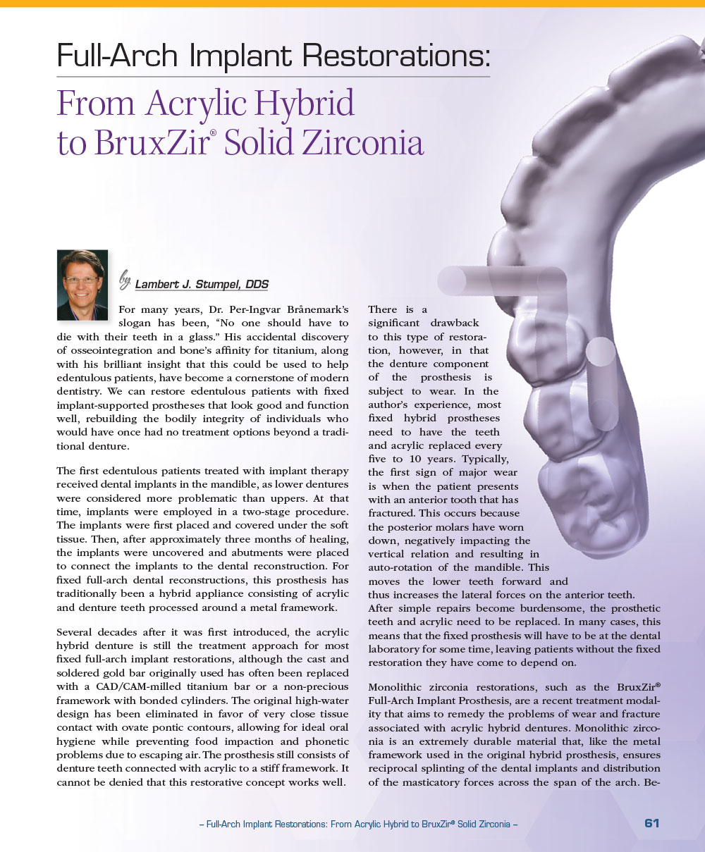 Full-Arch Implant Restorations: From Acrylic Hybrid to BruxZir® Solid Zirconia
