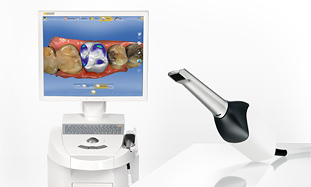 Sirona CEREC Technology Enables One Visit Crowns