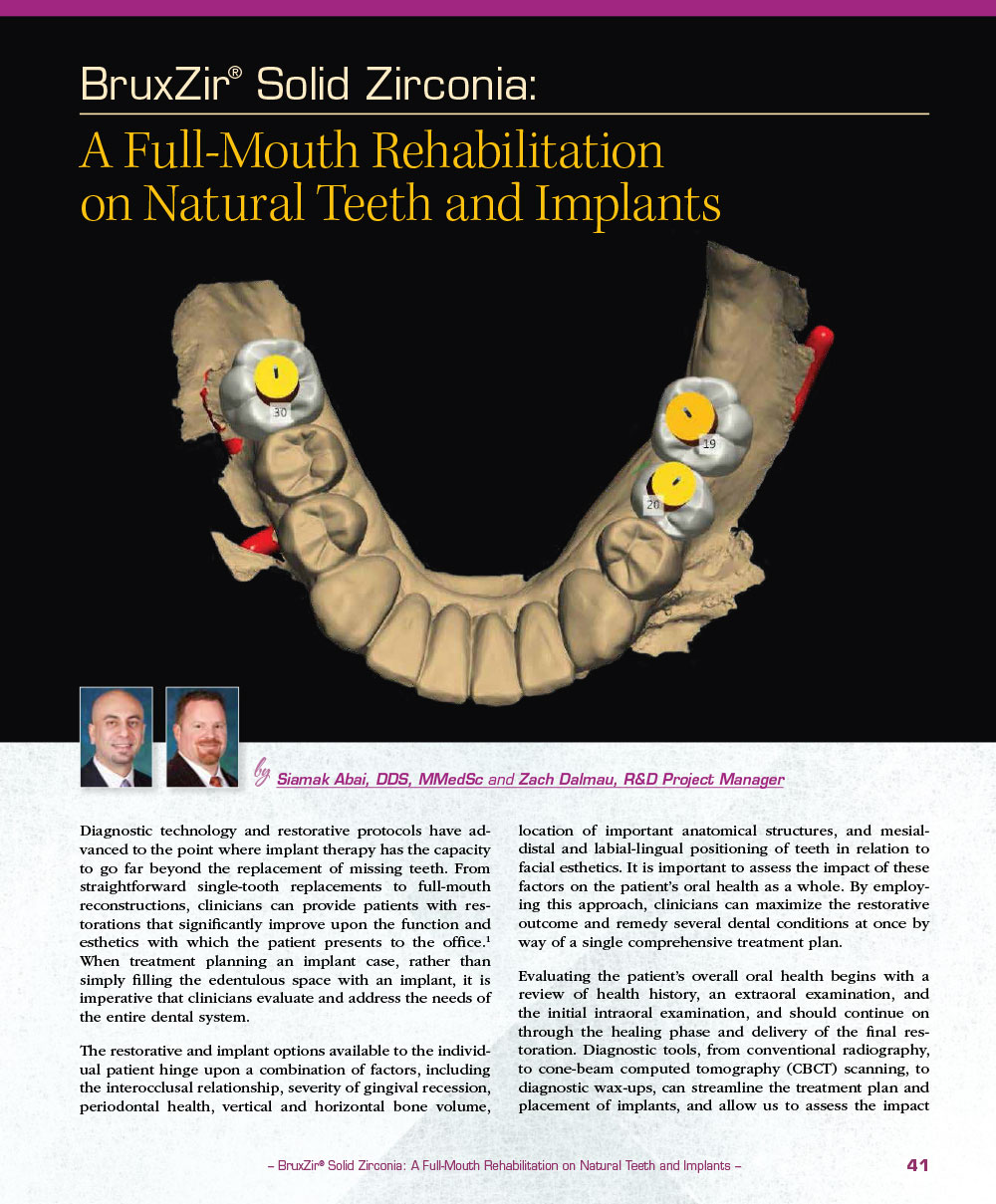 BruxZir® Solid Zirconia: A Full-Mouth Rehabilitation on Natural Teeth and Implants